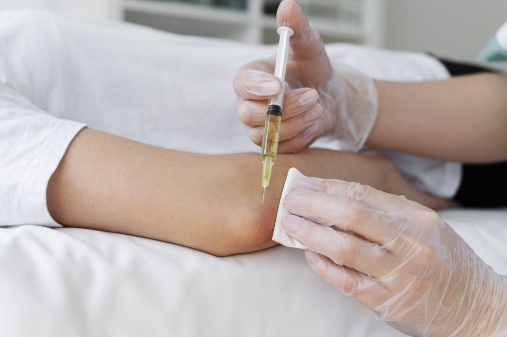 PRP Treatment
