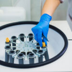 PRP Injections UK