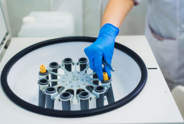 PRP Injections UK