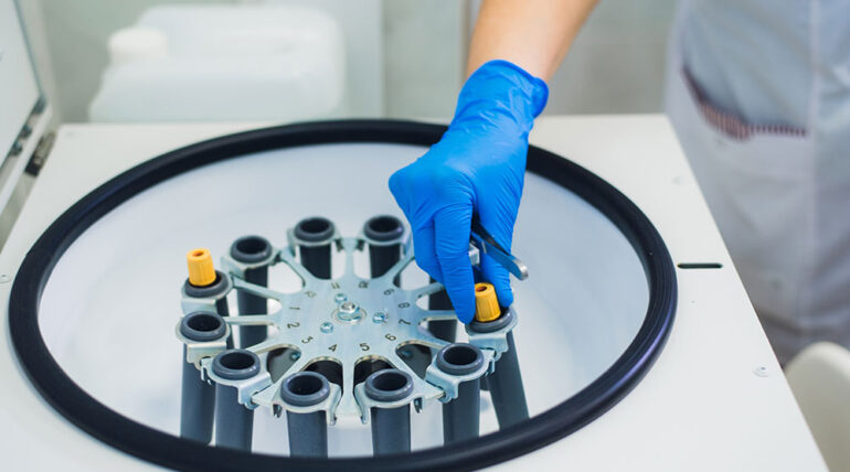 PRP Injections in UK: Uses, Suitability, Recovery and Questions to Ask