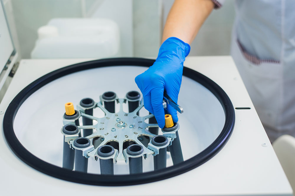 PRP Injections UK