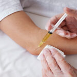 Arthrosamid-Injection
