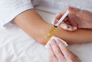 Arthrosamid-Injection