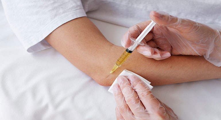 Arthrosamid Injection in London: Suitability, Recovery and Knee Osteoarthritis